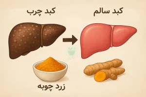 تصویر مقایسه کبد سالم و کبد چرب و خواص زردچوبه برای کبد چرب